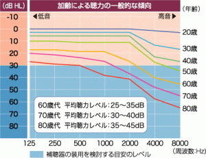 オージオグラム